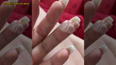 Woman claims botched acrylic nail job nearly cost her a finger: 'I'll never get my nails done again'
