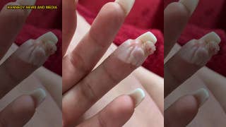 Woman claims botched acrylic nail job nearly cost her a finger - Fox News