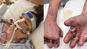 Missouri mom battling deadly sepsis infection loses all 10 toes, hand, several fingers