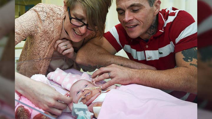 U.K. baby with rare heart defect defies odds of survival