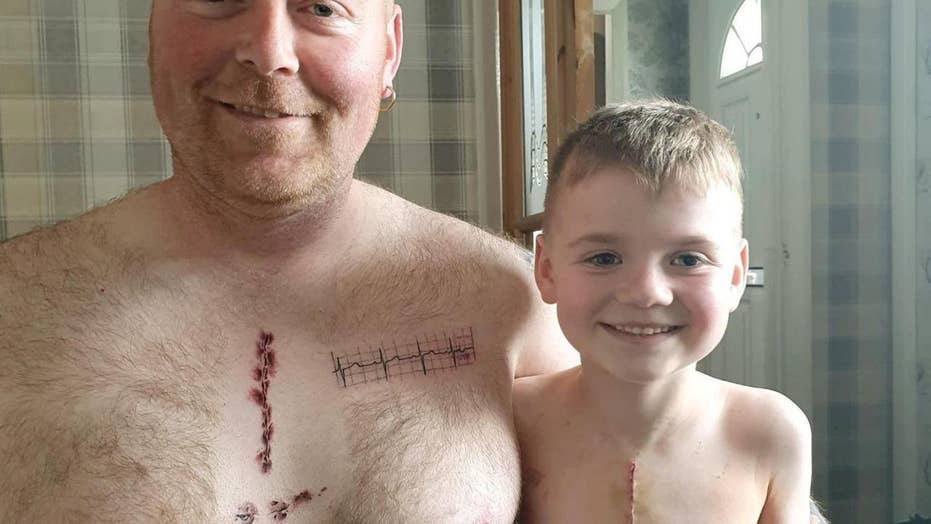 931px x 524px - Dad's tattoo matches son's life-saving heart surgery scar ...