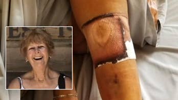Florida woman dies after contracting flesh-eating bacteria infection at beach, family says