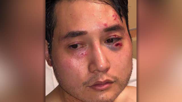 Antifa protesters attack conservative journalist sending him to the hospital