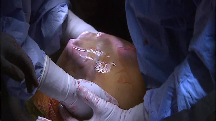 First baby born to mother who received uterus from deceased donor