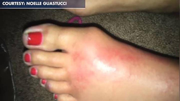 California woman rushed to hospital after contracting flesh-eating disease