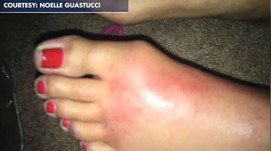 California woman rushed to hospital after contracting flesh-eating disease