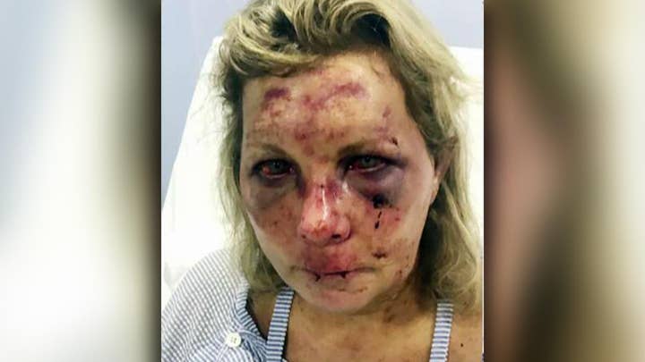 Woman says she was violently beaten while on vacation in Dominican Republic