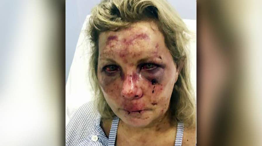 Woman says she was violently beaten while on vacation in Dominican Republic