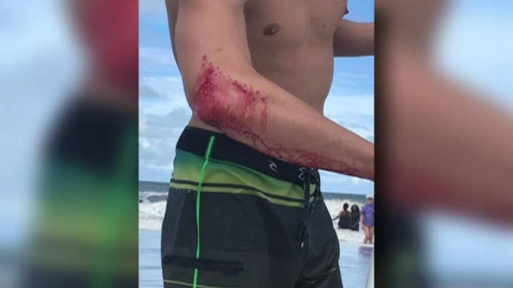 Professional surfer bitten by shark off Jacksonville Beach, Florida