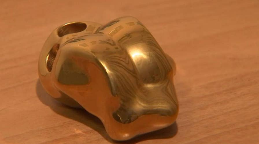 3D-printed ankle bone saves cancer patient's foot