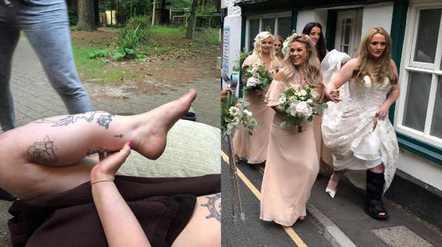 Bride nearly loses leg after freak bachelorette party accident