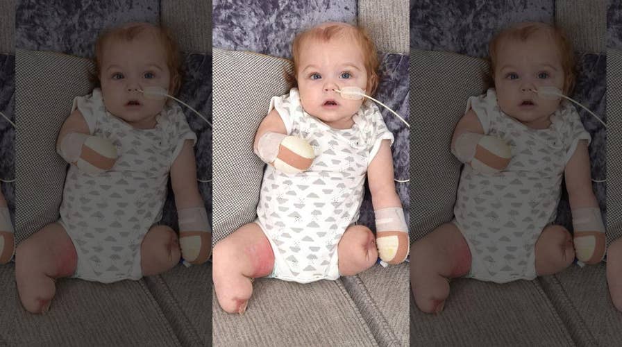 UK baby loses all 4 limbs following horrific sepsis infection