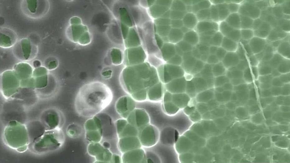 Scientists Discover New Link Between >> Scientists Finding New Ways To Fight Plastic Waste Fox News Scientists Discover New Link Between >> Scientists Finding New Ways To Fight Plastic Waste Fox News