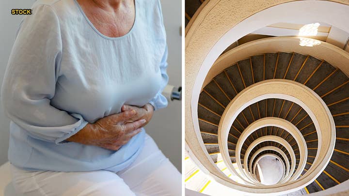 Swiss woman lives with a ‘spiraling’ esophagus