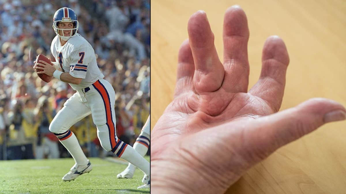 Football legend John Elway on his debilitating hand disorder