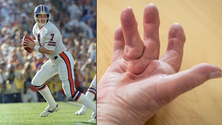 NFL legend John Elway on which defender he feared most and the hand disease he wants you to know about