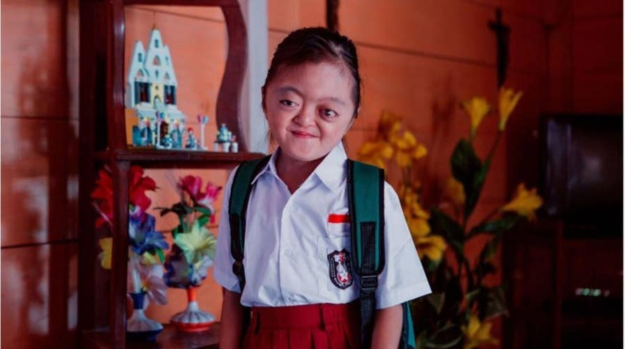 Girl bullied for rare condition finds joy in Jesus