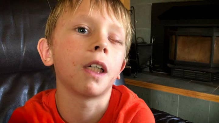 8-year-old Colorado boy survives mountain lion attack