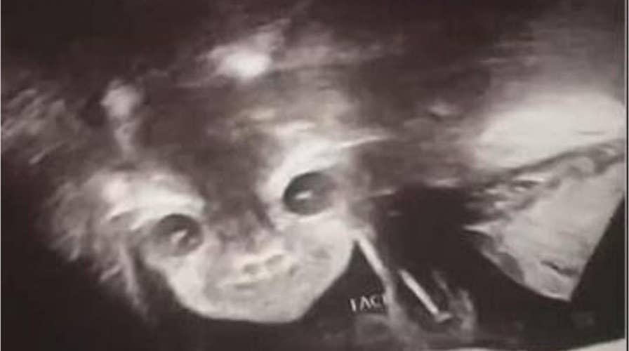 Ghastly image has mom thinking she’s carrying a demon baby