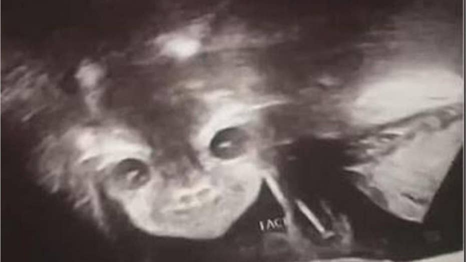 Satan's Daughter Is A Succubus Webtoon 'Demon' baby shocks parents in hilarious ultrasound pics | Fox News