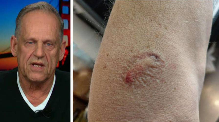 San Francisco business owner considers closing shop after being bitten by homeless person twice