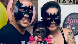 7-month-old infant heads to Russia to have ‘Batman’ mask markings treated - Fox News