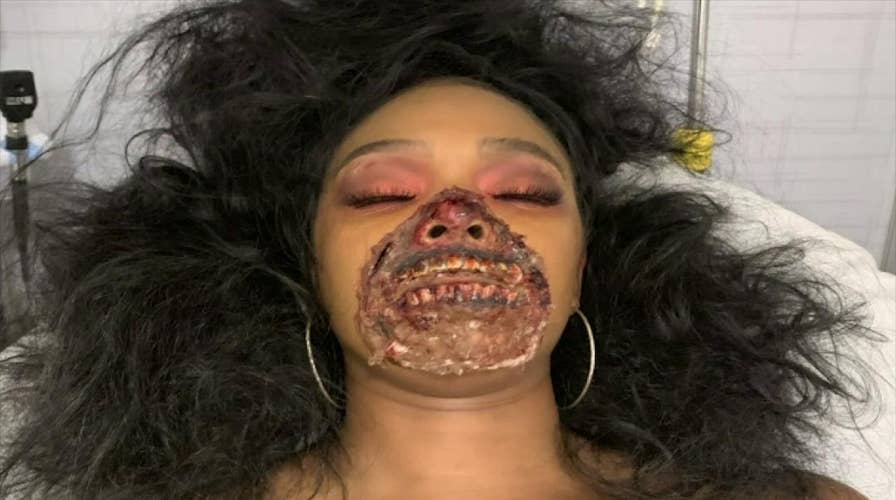 Model wearing zombie makeup rushed to the hospital, causes stir in emergency room