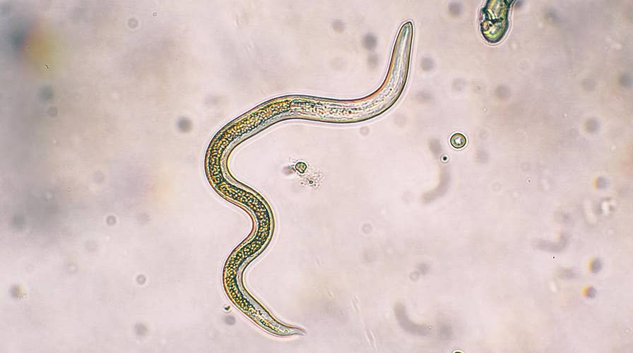 43-year-old man gets infected with a rare and dangerous parasite