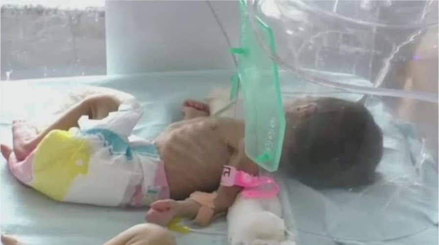 Newborn girl found buried alive in pot in India
