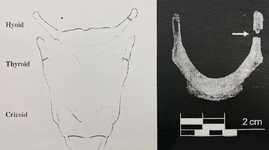 Family-hired medical examiner says Epstein death looks like a homicide