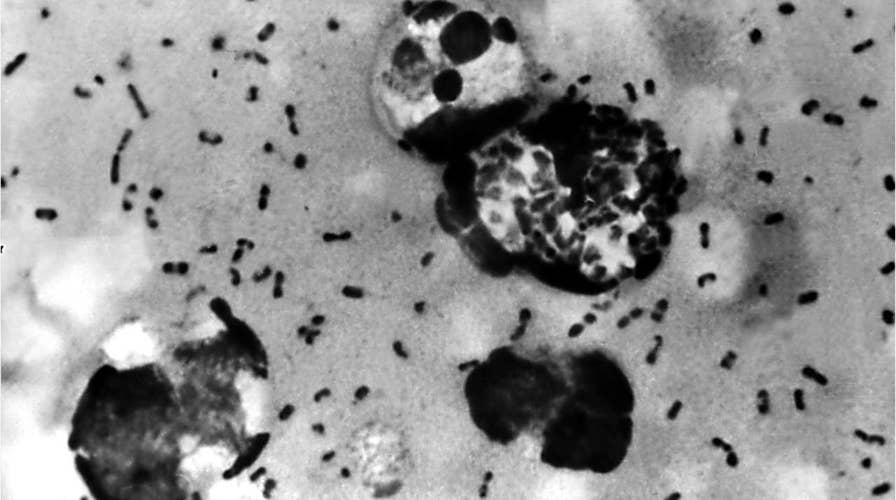 Two patients diagnosed in China with pneumonic plague