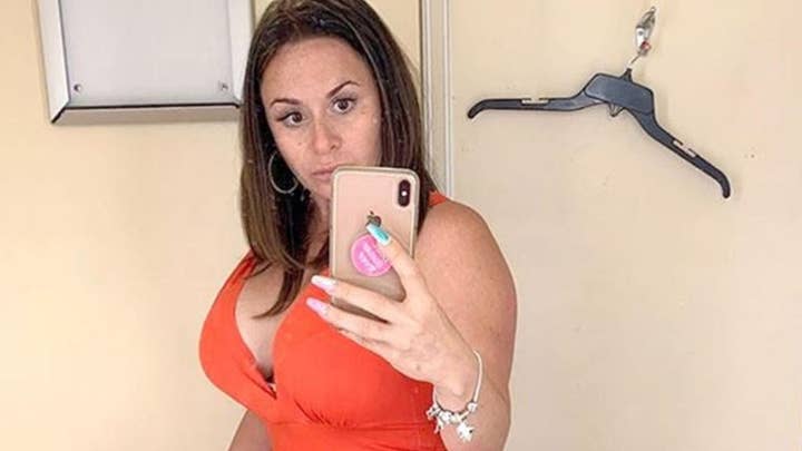 Woman left with lopsided breasts after botched boob implants exploded