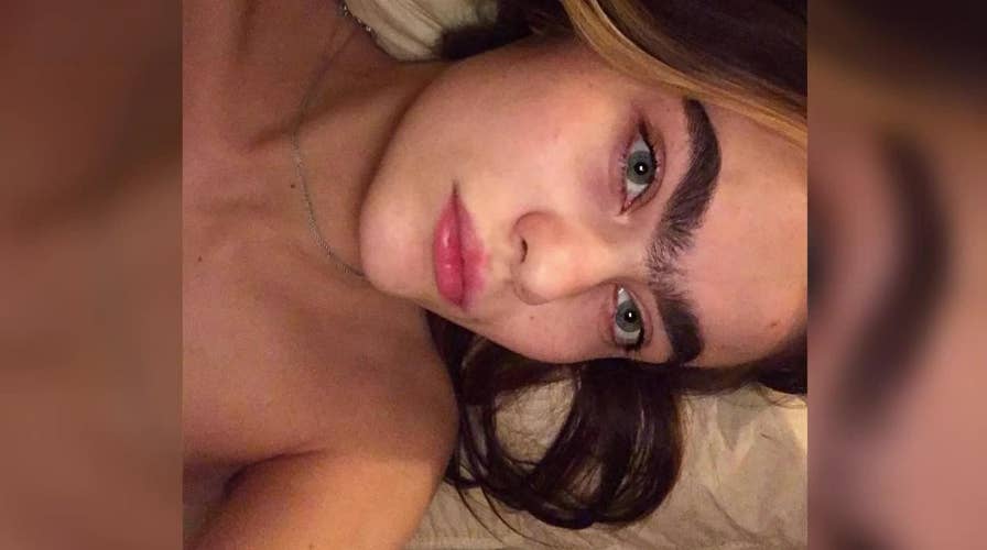 Unibrow Teen says she's inundated with dating requests