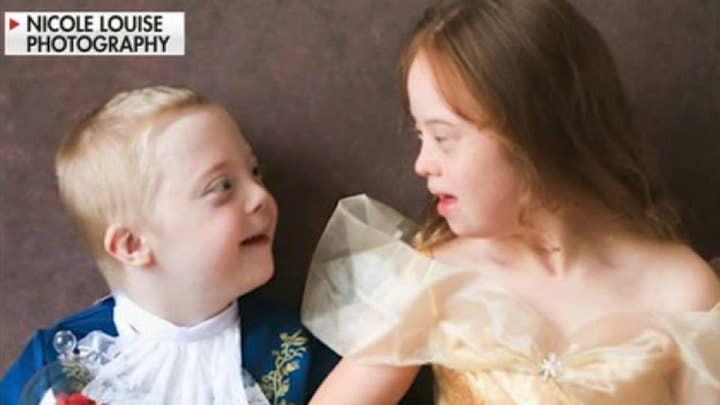 British photographer raises awareness for Down Syndrome