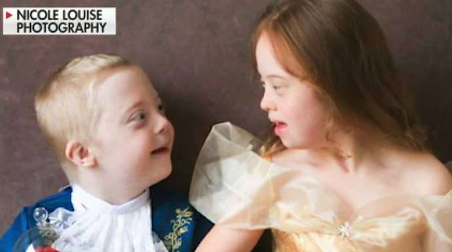 British photographer raises awareness for Down Syndrome