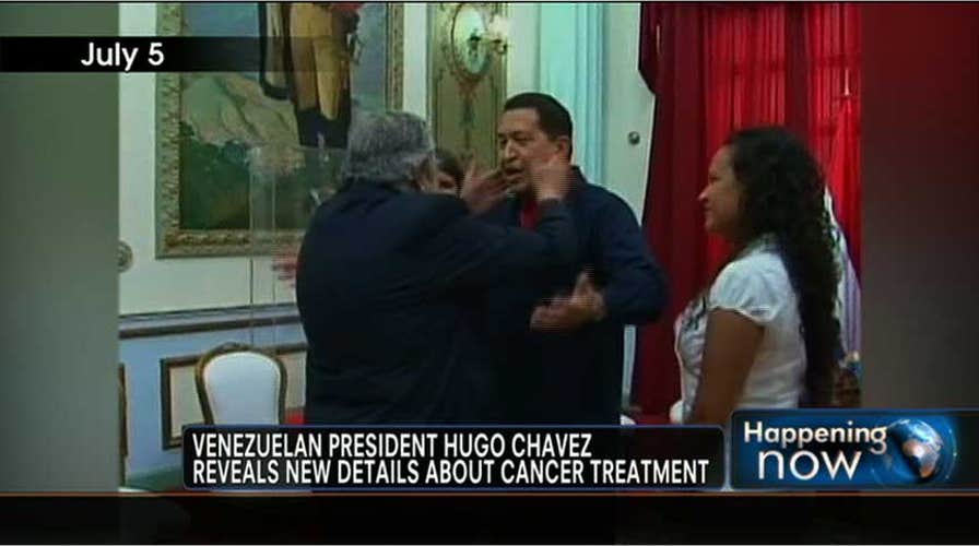Chavez Comments on Cancer Treatment