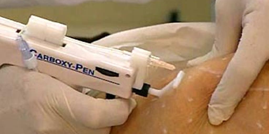 Lunch Break Lipo Fox News Video