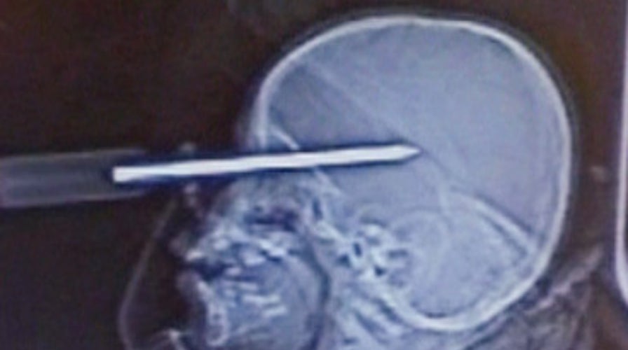 FOX News Screwdriver in the Head