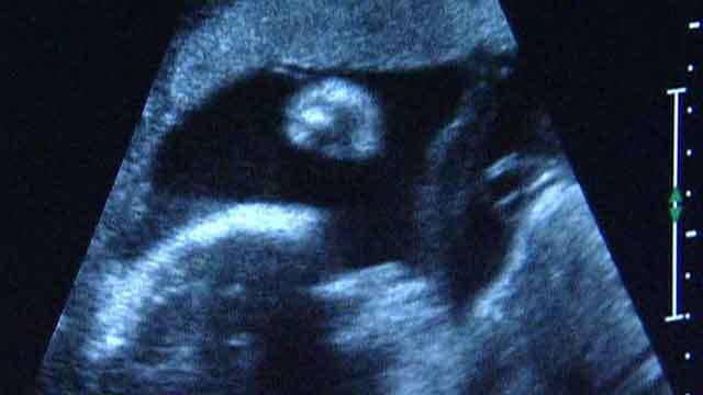 Ark.'s strict new abortion law takes focus in abortion fight | Fox News ...