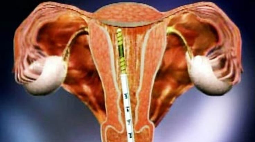 Hysterectomy Alternative