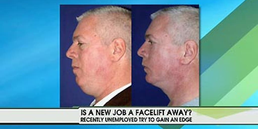Fox News Anchor Plastic Surgery Before After Doctors Weigh In On The Dramatic Changes - blmdcup