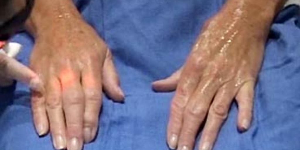 Hand Makeover Fox News Video