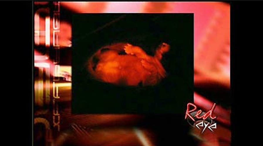 Furry and Florescent