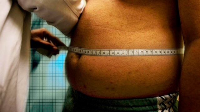 Obesity more deadly than first thought?