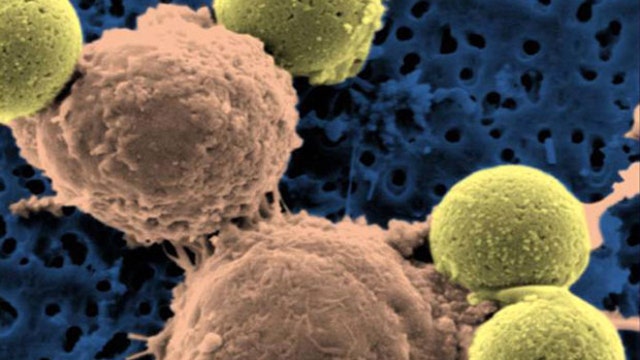 Report: Immune system boost 'fights cancer'