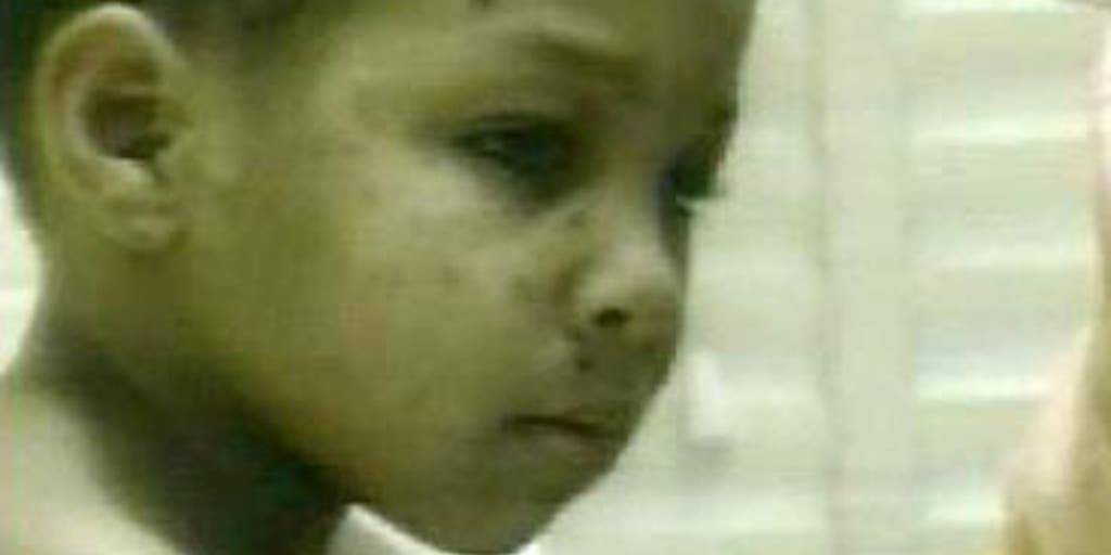 Chicken Pox Parties Fox News Video