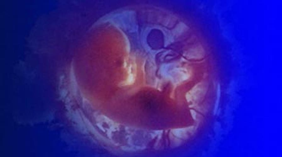 Abortion & the Election