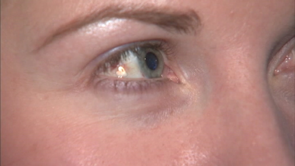 New procedure implants jewelry in the eye Latest News Videos Fox News