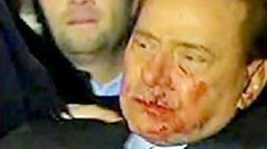 Prime Minister Attacked