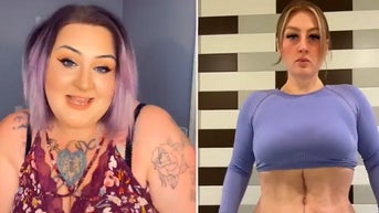 'Massive weight loss patient' describes horror of plastic surgery results